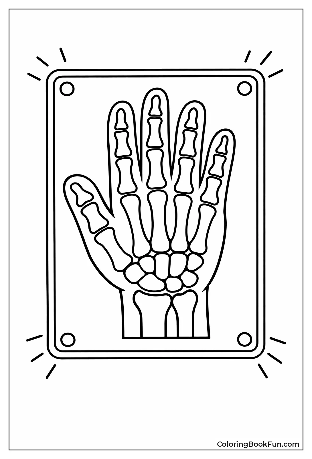 X-Ray Hand Bones View